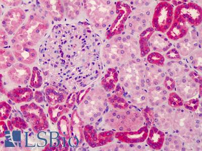 Anti-GRTP1 antibody IHC of human kidney. Immunohistochemistry of formalin-fixed, paraffin-embedded tissue after heat-induced antigen retrieval. Antibody LS-B4976 concentration 5 ug/ml.