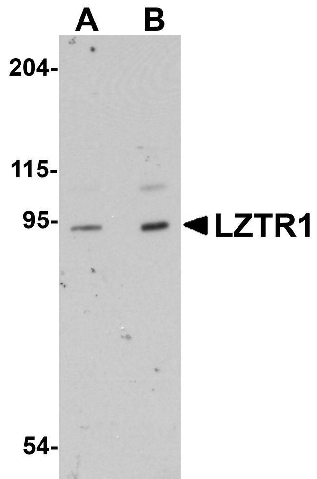Western blot analysis of LZTR1 in human heart tissue lysate with LZTR1 antibody at (A) 1 and (B) 2 ug/ml.