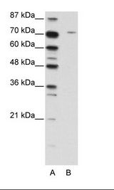A: Marker, B: Jurkat Cell Lysate