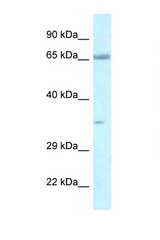 LZTS1 antibody LS-C145434 Western blot of Mouse Thymus lysate. Antibody concentration 1 ug/ml.