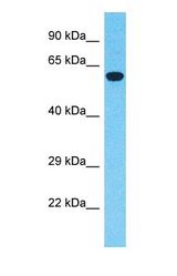 Western blot of LZTS1 Antibody with 293T Whole Cell lysate.