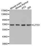 Western blot analysis of extracts of various cell lines, using LZTS1 antibody.