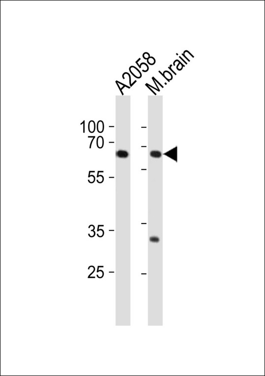 LZTS1 Antibody western blot of A2058 cell line and mouse brain tissue lysates (35 ug/lane). The LZTS1 antibody detected the LZTS1 protein (arrow).