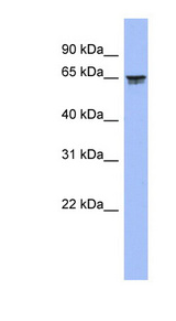 LZTS2 antibody LS-C112259 Western blot of Fetal Spleen lysate.