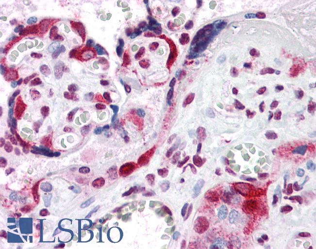 Anti-LZTS2 antibody IHC of human placenta. Immunohistochemistry of formalin-fixed, paraffin-embedded tissue after heat-induced antigen retrieval. Antibody LS-B4717 concentration 5 ug/ml.