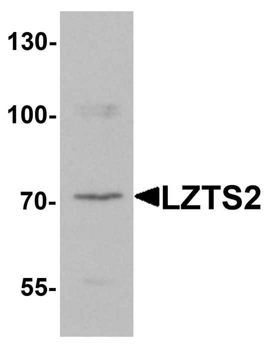 Western blot analysis of LZTS2 in human kidney tissue lysate with LZTS2 antibody at 1 ug/ml.
