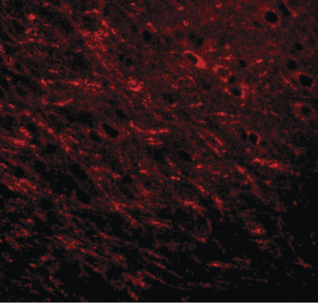 Immunofluorescence of Prosapip 1 in rat brain tissue with Prosapip 1 antibody at 20 ug/ml.