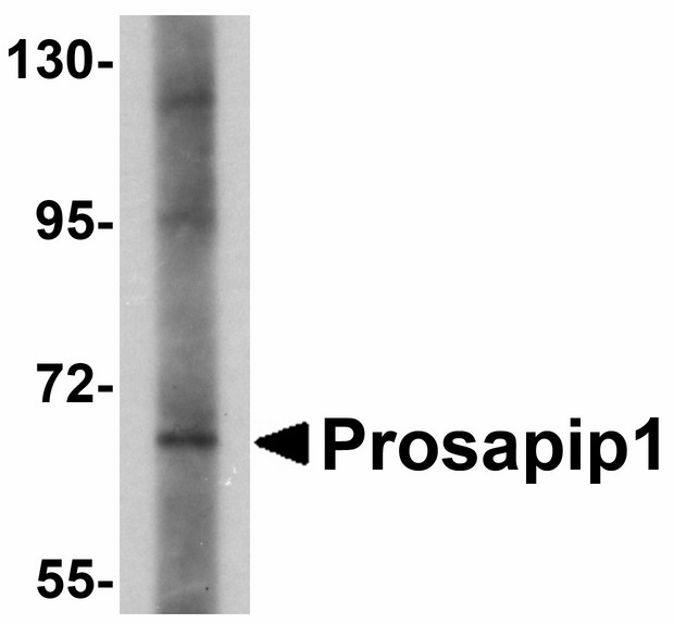 Western blot of Prosapip1 in SK-N-SH cell lysate with Prosapip1 antibody at 1 ug/ml. Below: Immunohistochemistry of Prosapip1 in rat brain tissue with Prosapip1 antibody at 2.5 ug/ml.