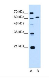 Lane A: Marker. Lane B: Jurkat cell lysate. Antibody concentration: 0.25 ug/ml. Gel concentration: 12%.