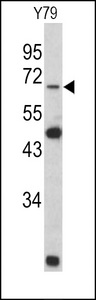 Western blot of Lamin B2 Antibody in Y79 cell line lysates (35 ug/lane). Lamin B2 (arrow) was detected using the purified antibody.