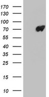 HEK293T cells were transfected with the pCMV6-ENTRY control (Left lane) or pCMV6-ENTRY LMNB2 (Right lane) cDNA for 48 hrs and lysed. Equivalent amounts of cell lysates (5 ug per lane) were separated by SDS-PAGE and immunoblotted with anti-LMNB2.