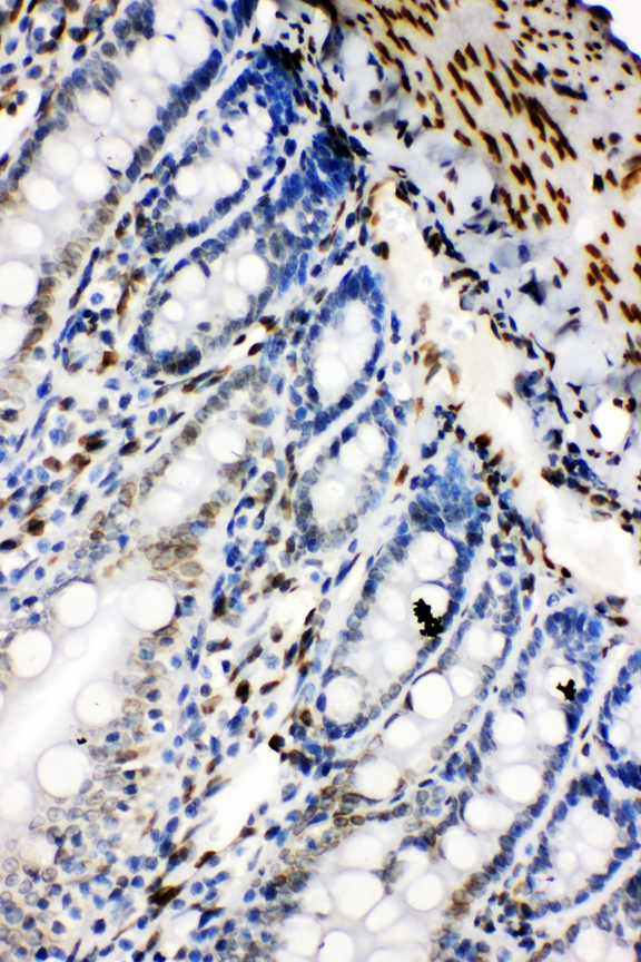Lamin B2 antibody. IHC(P): Rat Intestine Tissue.