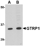 Western blot of GRTP1 in K562 cell lysate with GRTP1 antibody at (A) 1 and (B) 2 ug/ml.