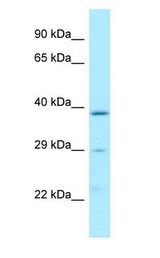 Latexin / MUM antibody Western Blot of MCF7.