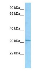 Latexin / MUM antibody Western Blot of A549 cell lysate. LXN is supported by BioGPS gene expression data to be expressed in A549.
