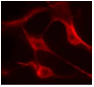 Immunohistochemical staining for latexin in rat brain tissue
