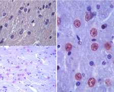 IHC of Latexin in paraffin-embedded formalin-fixed rat brain tissue using an isotype control (top, left) and LS-C148429 (bottom, left and right (100X)) at 1:100.