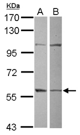 Sample (30 ug of whole cell lysate) A: 293T B: Raji 7.5% SDS PAGE GRWD1 antibody diluted at 1:500