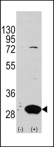 Western blot of Latexin (arrow) using rabbit polyclonal Latexin Antibody (RB12661). 293 cell lysates (2 ug/lane) either nontransfected (Lane 1) or transiently transfected with the LXN gene (Lane 2) (Origene Technologies).