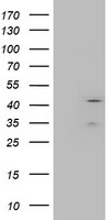 HEK293T cells were transfected with the pCMV6-ENTRY control (Left lane) or pCMV6-ENTRY LAYN (Right lane) cDNA for 48 hrs and lysed. Equivalent amounts of cell lysates (5 ug per lane) were separated by SDS-PAGE and immunoblotted with anti-LAYN.
