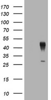 HEK293T cells were transfected with the pCMV6-ENTRY control (Left lane) or pCMV6-ENTRY LAYN (Right lane) cDNA for 48 hrs and lysed. Equivalent amounts of cell lysates (5 ug per lane) were separated by SDS-PAGE and immunoblotted with anti-LAYN.