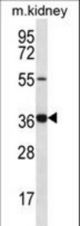 GRXCR1 Antibody western blot of mouse kidney tissue lysates (35 ug/lane). The GRXCR1 antibody detected the GRXCR1 protein (arrow).