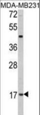 Western blot of hLep-R149 in MDA-MB231 cell line lysates (35 ug/lane). LEP (arrow) was detected using the purified antibody.