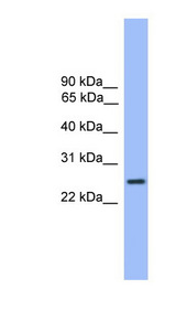 GOSR1 antibody LS-C135541 Western blot of Fetal Liver lysate.