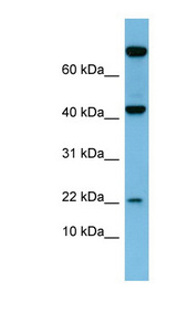 LEP / Leptin antibody LS-B4651 Western blot of Fetal Small Intestine lysate.