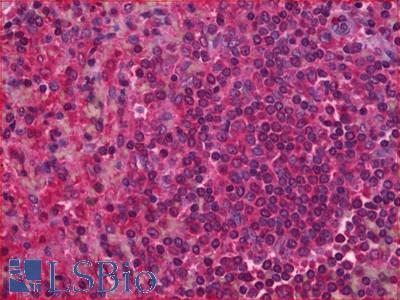 Anti-Leukotriene B4 Receptor antibody IHC of human spleen. Immunohistochemistry of formalin-fixed, paraffin-embedded tissue after heat-induced antigen retrieval. Antibody LS-B6972 dilution 1:200.