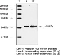 Western blot of Leukotriene B4 Receptor / BLT1 antibody LS-B6972.