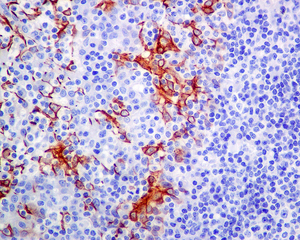 IHC of paraffin-embedded human tonsil tissue using anti-Leukotriene B4 Receptor antibody.