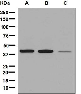 Western blot analysis on (A) human thymus, (B) fetal lung, and (C) A549 cell lysates using anti-Leukotriene B4 Receptor antibody.