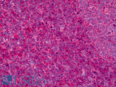 Anti-Leukotriene B4 Receptor antibody IHC of human tonsil. Immunohistochemistry of formalin-fixed, paraffin-embedded tissue after heat-induced antigen retrieval. Antibody LS-B6953 concentration 5 ug/ml.
