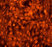 Immunofluorescent staining of HeLa cells using anti-GOS-28 antibody.