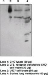 Western blot of Leukotriene B4 Receptor / BLT1 antibody LS-B6953.