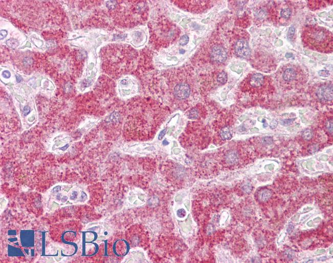 Anti-Leukotriene B4 Receptor antibody IHC of human liver. Immunohistochemistry of formalin-fixed, paraffin-embedded tissue after heat-induced antigen retrieval. Antibody LS-B6527 concentration 10 ug/ml.