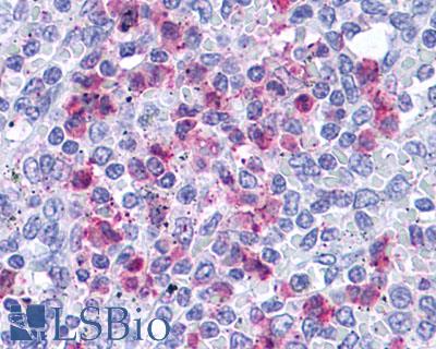 Anti-Leukotriene B4 Receptor antibody LS-A1495 IHC of human spleen, red pulp. Immunohistochemistry of formalin-fixed, paraffin-embedded tissue after heat-induced antigen retrieval.