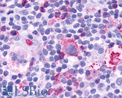 Anti-Leukotriene B4 Receptor / BLT1 antibody IHC of human Lymph Node, Hodgkins Lymphoma. Immunohistochemistry of formalin-fixed, paraffin-embedded tissue after heat-induced antigen retrieval.