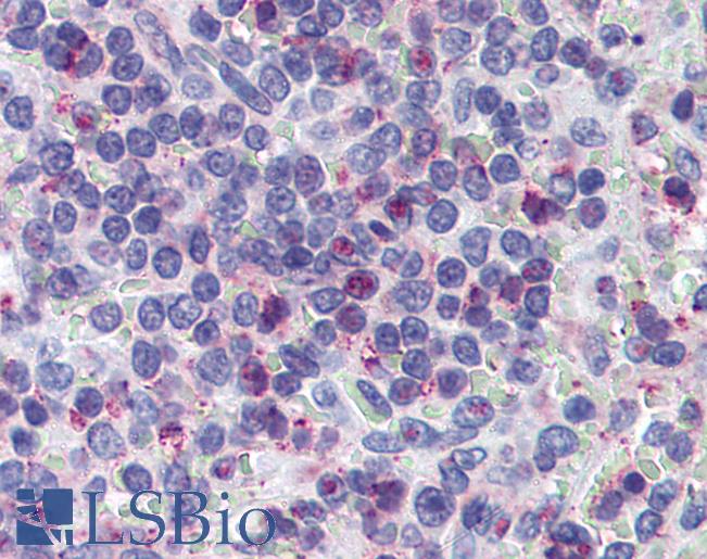 Anti-Leukotriene B4 Receptor antibody LS-A1493 IHC of human spleen, red pulp. Immunohistochemistry of formalin-fixed, paraffin-embedded tissue after heat-induced antigen retrieval.
