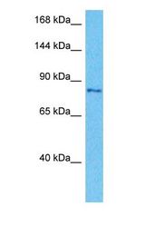 Western blot of GSAP Antibody with human 721_B Whole Cell lysate.