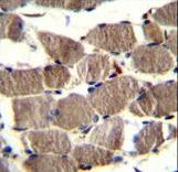 PION Antibody immunohistochemistry of formalin-fixed and paraffin-embedded human skeletal muscle followed by peroxidase-conjugated secondary antibody and DAB staining.