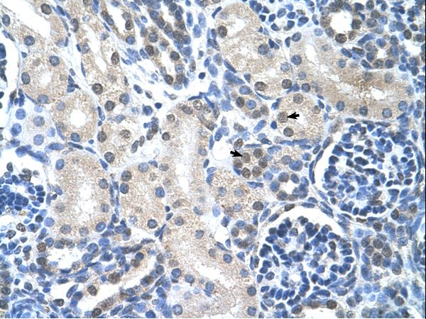 LOR / Loricrin antibody LS-C31863 was used in IHC to stain formalin-fixed, paraffin-embedded human kidney.