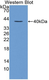 Western blot of recombinant Loricrin.
