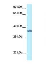 LUM / Lumican antibody LS-C146149 Western blot of Mouse Heart lysate. Antibody concentration 1 ug/ml.