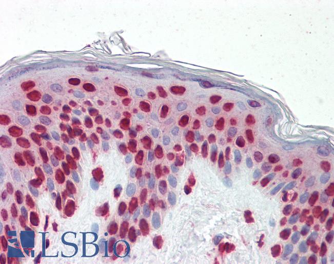 Anti-GSC / Goosecoid antibody IHC staining of human skin. Immunohistochemistry of formalin-fixed, paraffin-embedded tissue after heat-induced antigen retrieval.