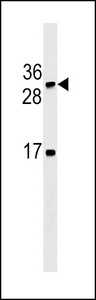 LTB Antibody western blot of HL-60 cell line lysates (35 ug/lane). The LTB antibody detected the LTB protein (arrow).