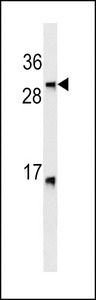 LTB Antibody western blot of HL-60 cell line lysates (35 ug/lane). The LTB antibody detected the LTB protein (arrow).