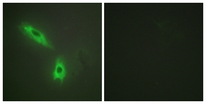 Immunofluorescence of HeLa cells, using TNFC Antibody. The picture on the right is treated with the synthesized peptide.