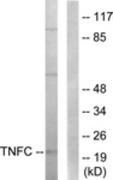 Western blot of extracts from HepG2 cells, using TNFC Antibody. The lane on the right is treated with the synthesized peptide.